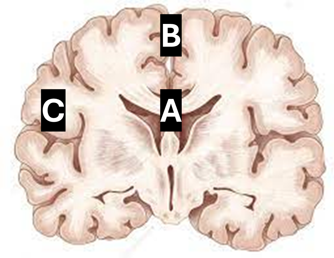 <p><strong>Using anatomical orientation terms, brain region “B” is ______ to brain region “A".</strong></p><p><span style="color: red">Answer Choices:</span></p><ul><li><p><span style="color: red">Superior</span></p></li><li><p><span style="color: red">Dorsal</span></p></li><li><p><span style="color: red">Posterior</span></p></li><li><p><span style="color: red">Lateral</span></p></li></ul><p></p>