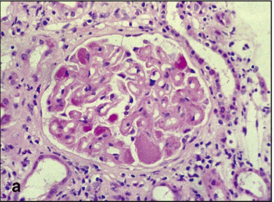 <p>What condition is this</p>