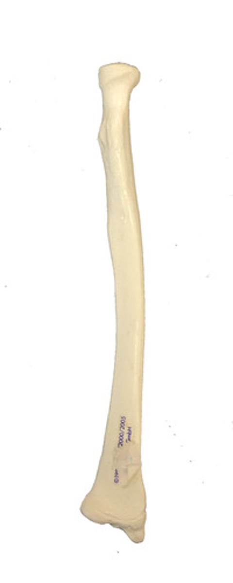 <p>Identify this bone.</p>