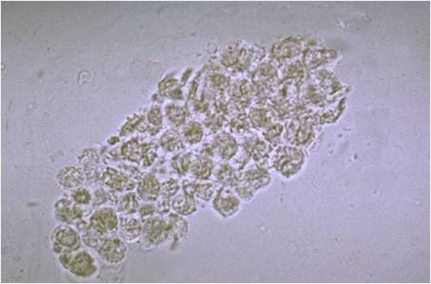 <p>Contain WBCs, mostly neutrophils</p>