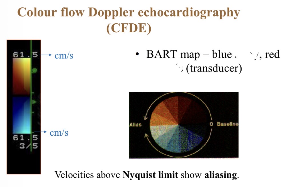 <p>Colour flow Doppler - Blue colour meaning</p>