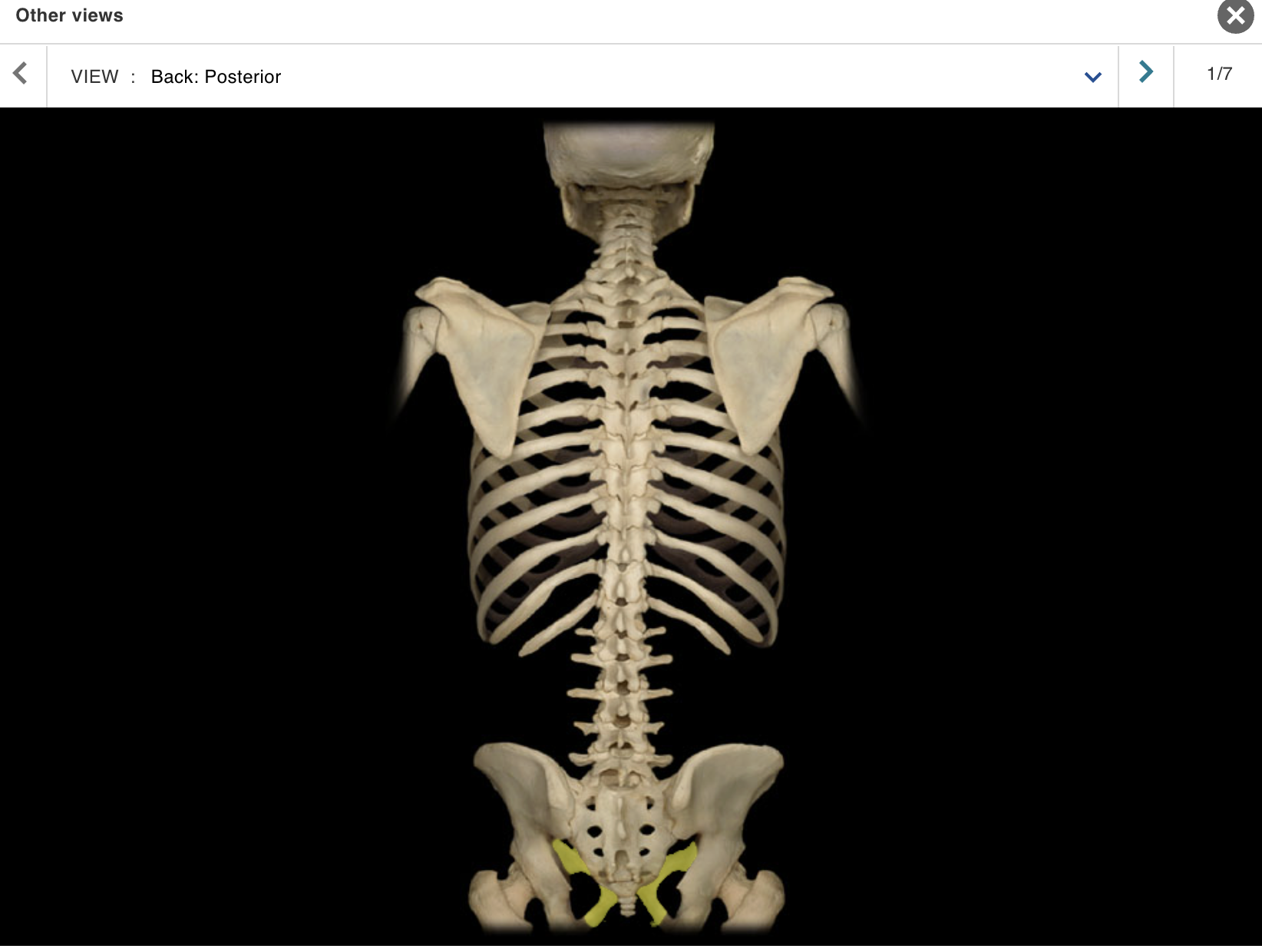 <p>Location:</p><p class="p1">• Pelvis</p><p class="p1">Description:</p><ul><li><p>﻿﻿One of three coxal (hip) bones</p></li><li><p>﻿﻿Characteristic features include body and rami (superior and inferior)</p></li><li><p>﻿﻿Midline junction of pubic bones forms pubic symphysis</p></li><li><p>﻿﻿Contributes to acetabulum (hip joint socket), obturator foramen, and wall of lesser (true) pelvis</p></li></ul><p>Comment:</p><ul><li><p>﻿﻿Fused with ilium and ischium in adult to form coxal (hip) bone</p></li><li><p>﻿﻿Bony pelvis formed by paired hip bones and sacrum</p></li><li><p>﻿﻿Obturator foramen formed by rami of pubis and ischium</p></li></ul><p></p>