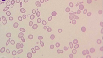 <p>pale centers of &gt;3um</p>