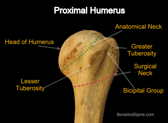 <p>1/3 of a sphere, articulates with glenoid fossa (because glenoid is very shallow and why dislocated shoulders are common); contains the greater and lesser tuberosities which are divided by an intertubercular notch/groove</p>