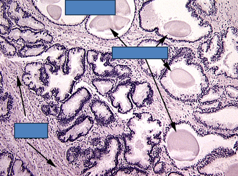<p>Identify this structure</p>