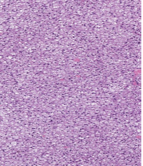 <p>What connective tissue cell is shown in the following image?</p>