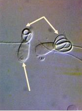 <p>Identify the sperm morphology.</p>