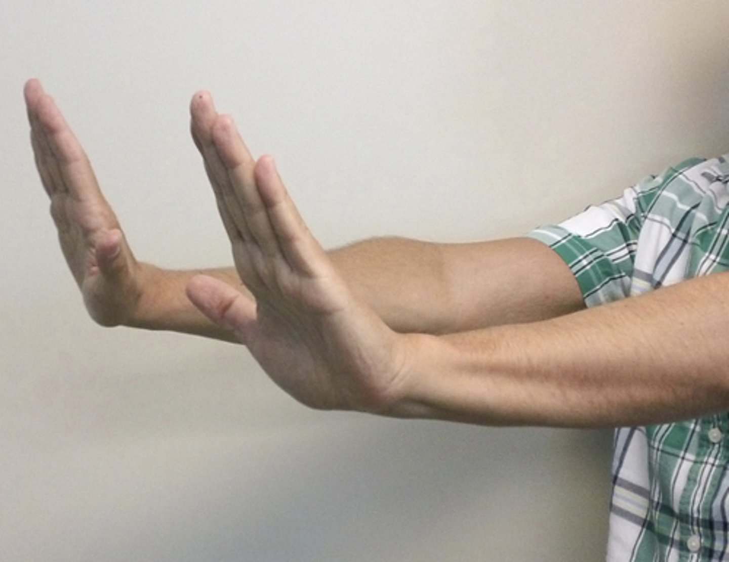 <p>Sudden, brief, nonrhythmic flexion of hands and fingers after asking patient to "stop traffic"</p><p>Can indicate hepatic failure encephalopathy, uremic syndrome, or barbiturate overdose</p>