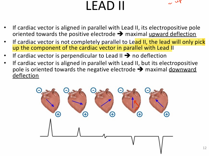 <p>1) cardiac vector is PARALLEL w/ lead 2<br>→ maximal upward deflection (i.e., electropositive pole is pointing toward positive electrode)</p><p></p><p>2) if NOT PARALLEL, lead 2 will only pick up the vector components parallel to lead 2</p><p></p><p>3) if PERPENDICULAR (cross), NO deflection</p><p></p><p>4) if PARALLEL but electropositive pole is pointing towards neg electrode = MAXIMAL DOWNWARD DEFLECTION</p>