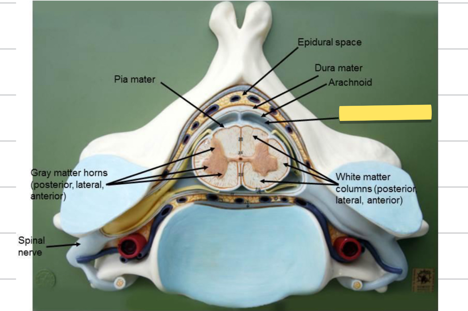 <p>Name this spinal cord part</p>