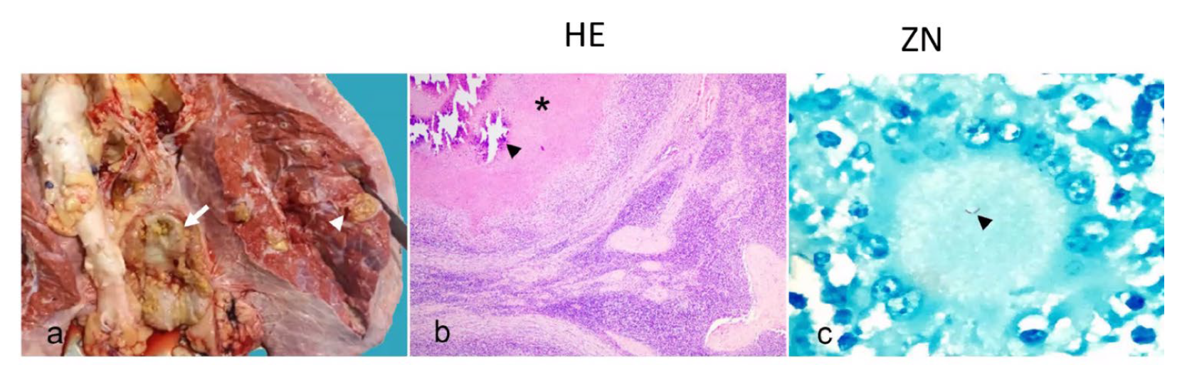 <p>What is the etiology?</p><p>A-Mycoplasma bovis</p><p>B-Actinomyces pyogenes</p><p>B-Mycobacterium bovis</p><p>C-Nocardia asteroides</p>