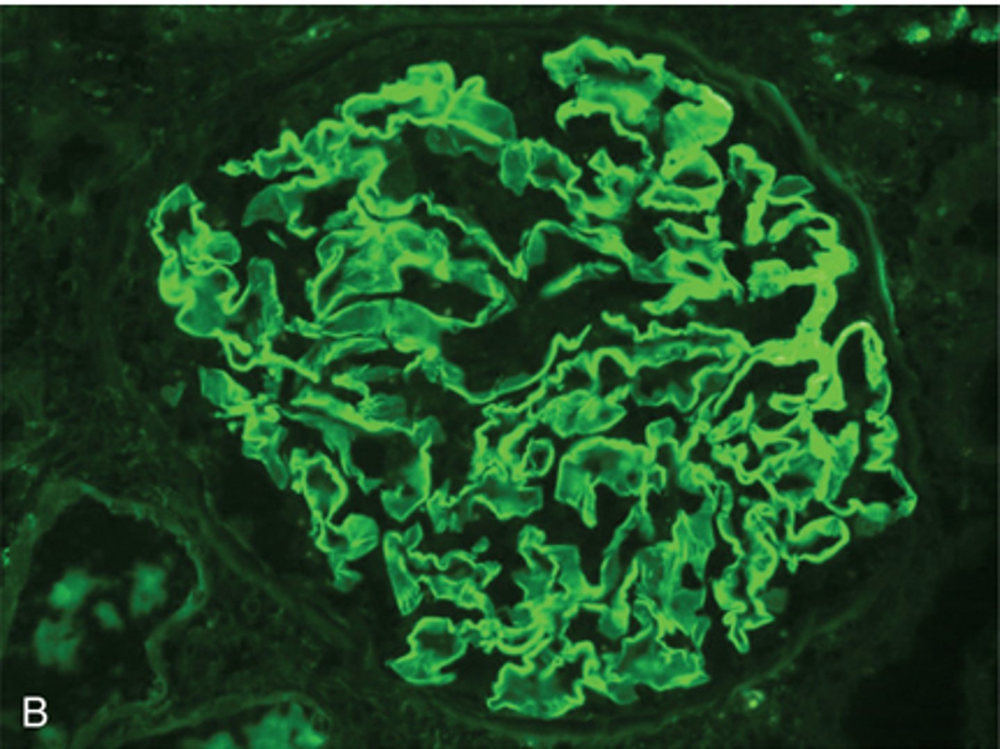 <p>Used for situ hybridization that can be used to diagnose malignancy by enabling the quantification of select chromosomes present in a cell</p><p>Also visualize fluorescein Isothiocyanate in immunohistochemical staining</p><p>Auramine Rhodamine with acid fast bacilli</p>