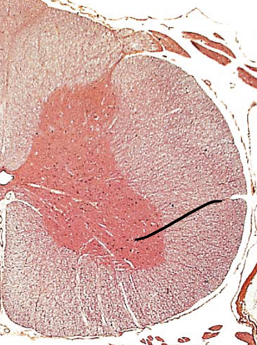 <p><span>floor of grey horns</span></p>