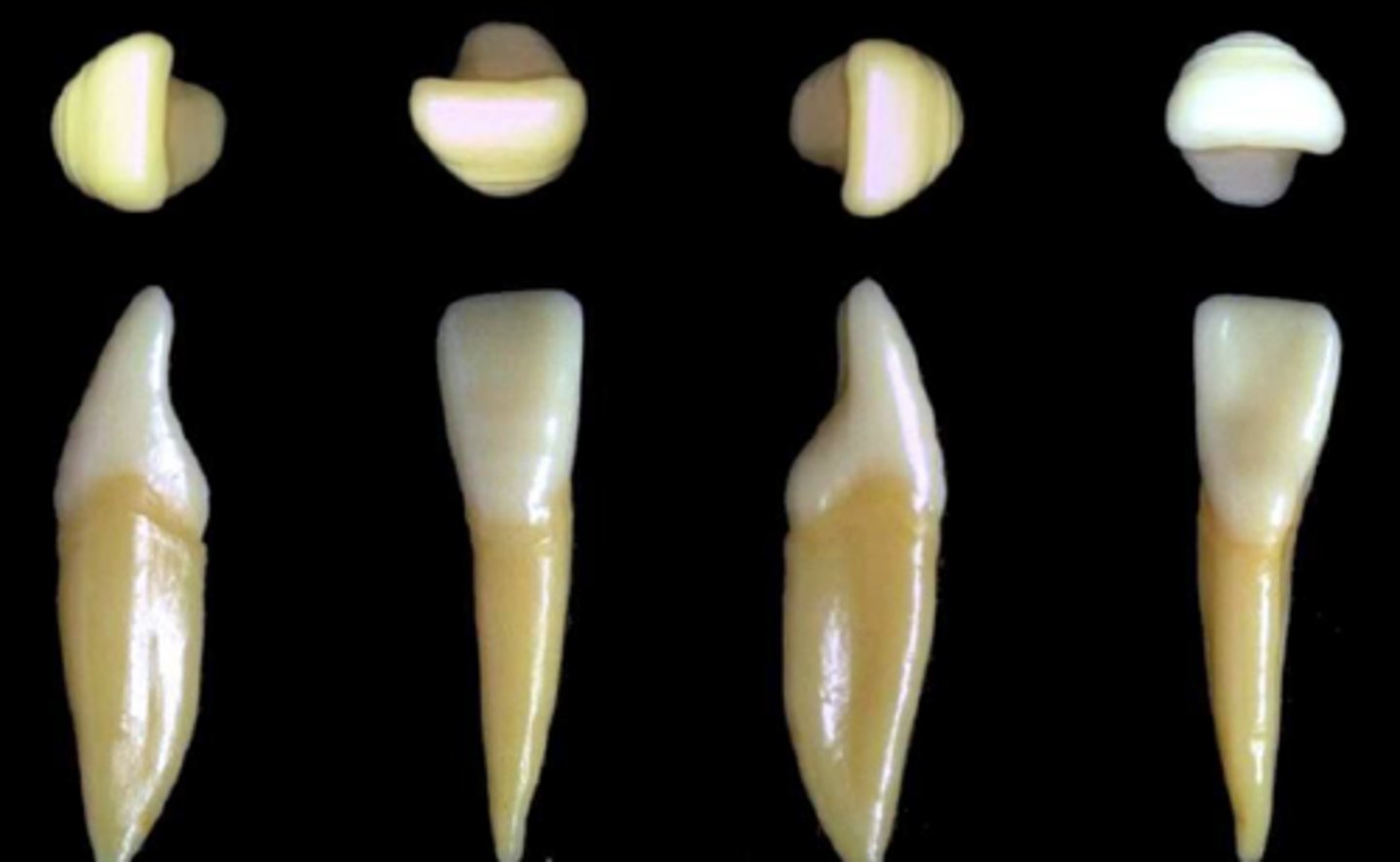 <p>what tooth is this &amp; why?</p>