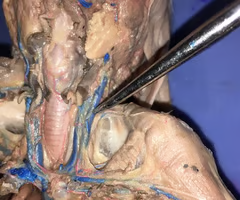 <p>What is the arrow pointing to? What’s it function? </p>