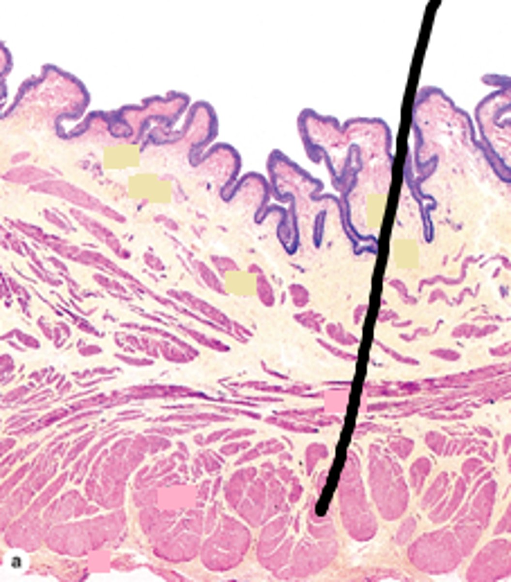 <p>Identify this urinary system structure.</p>