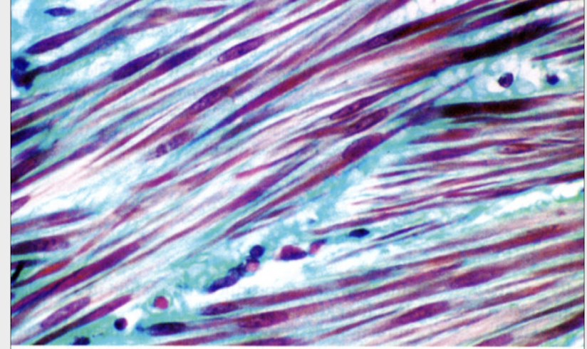 <p>extra stain; Masson trichrome stain </p><p>-reticular fibers (CT) is so thin that is not able to be visualized by regular H&E stain </p>