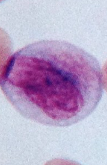 <p>What WBC is this?</p>