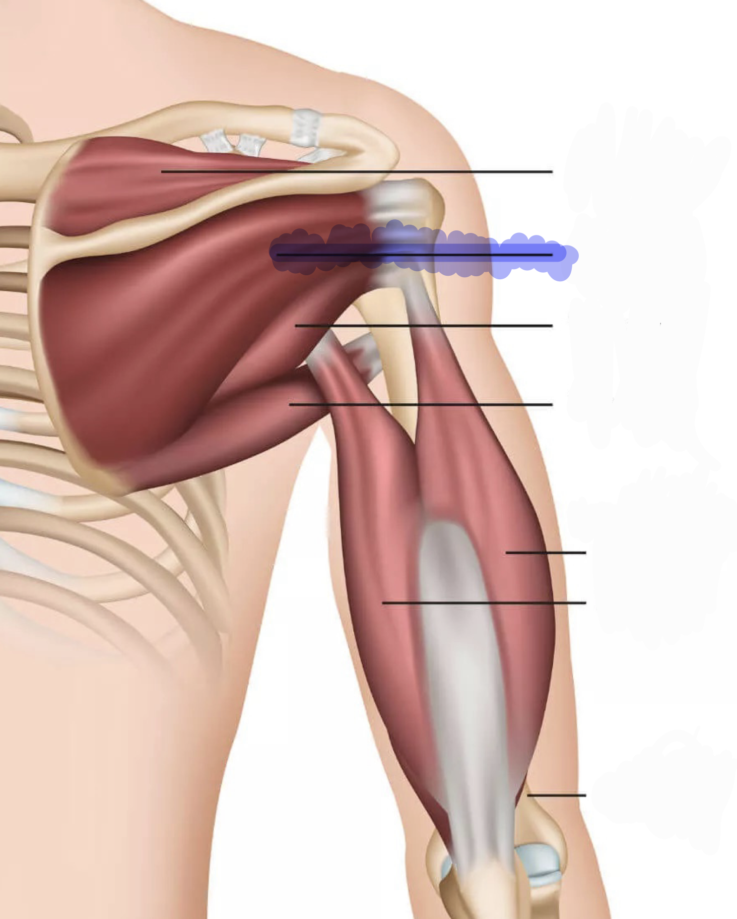 <p>Lateral rotation of shoulder (humerus); horizontal ADduction of humerus [shoulder]</p>