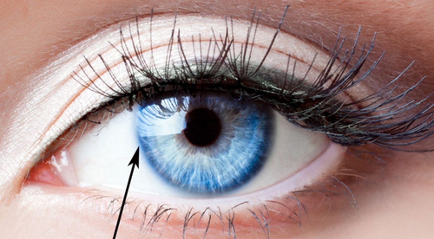 <p>border between cornea and sclera</p><p>bluish outline</p>