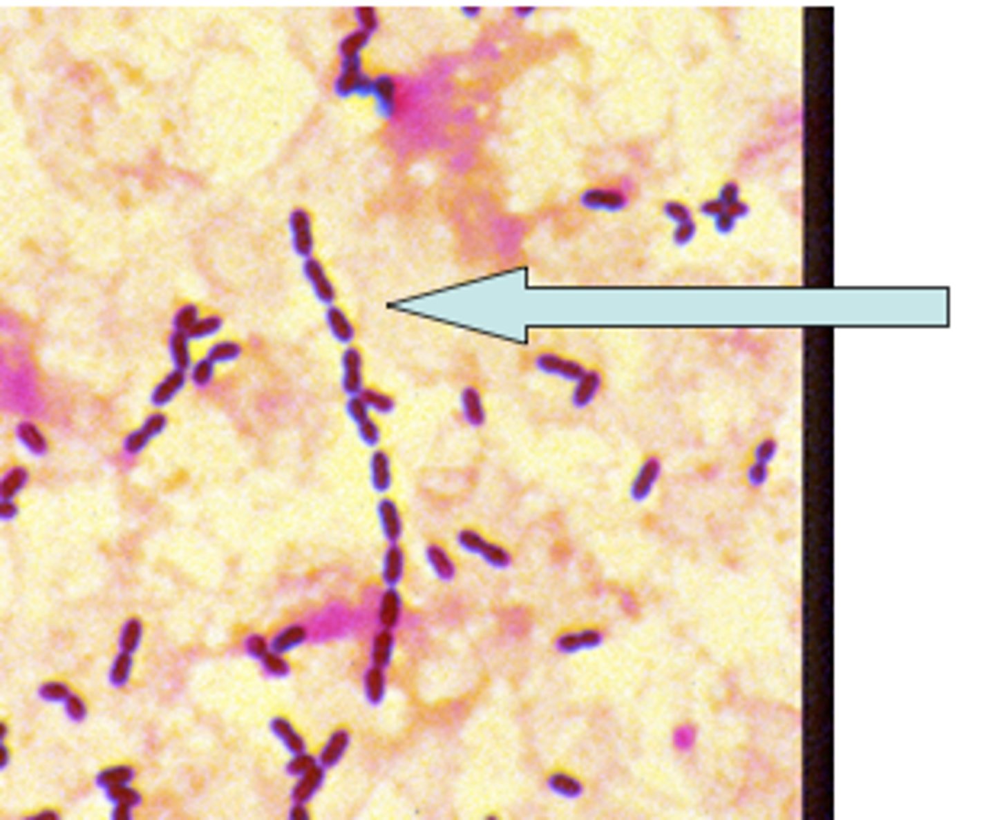 <p>chains of bacilli</p>