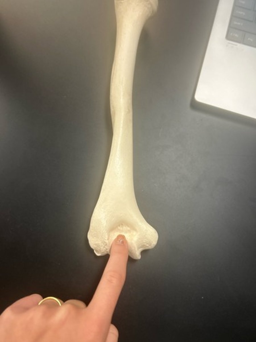 <p>name the bone</p>