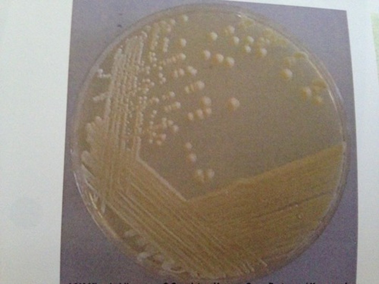 <p>colorless and smooth -- similar to bacteria</p>