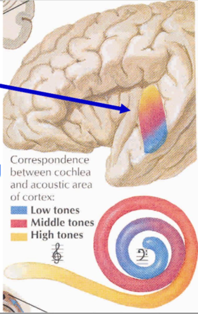 <p>Transverse temporal gyrus</p>