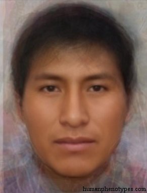 <p>Identify this Phenotype</p>