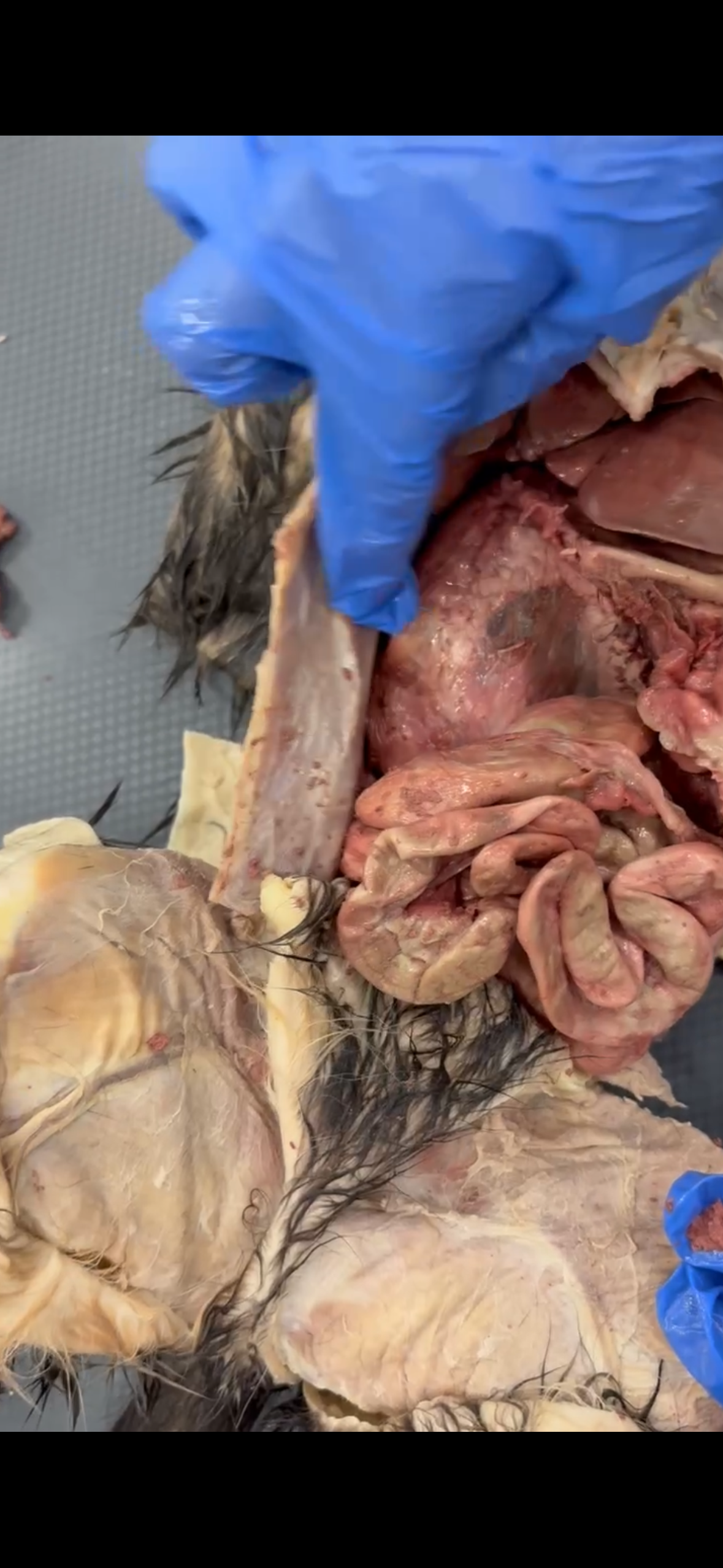 <p>Overall Structure (btwn duodenum)</p>