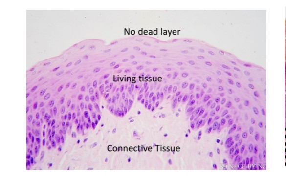 <p>Stratified squamous epithelium</p>
