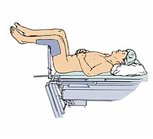 A supine position with the hips and knees fully flexed 

Used to perform **female internal pelvic examination**