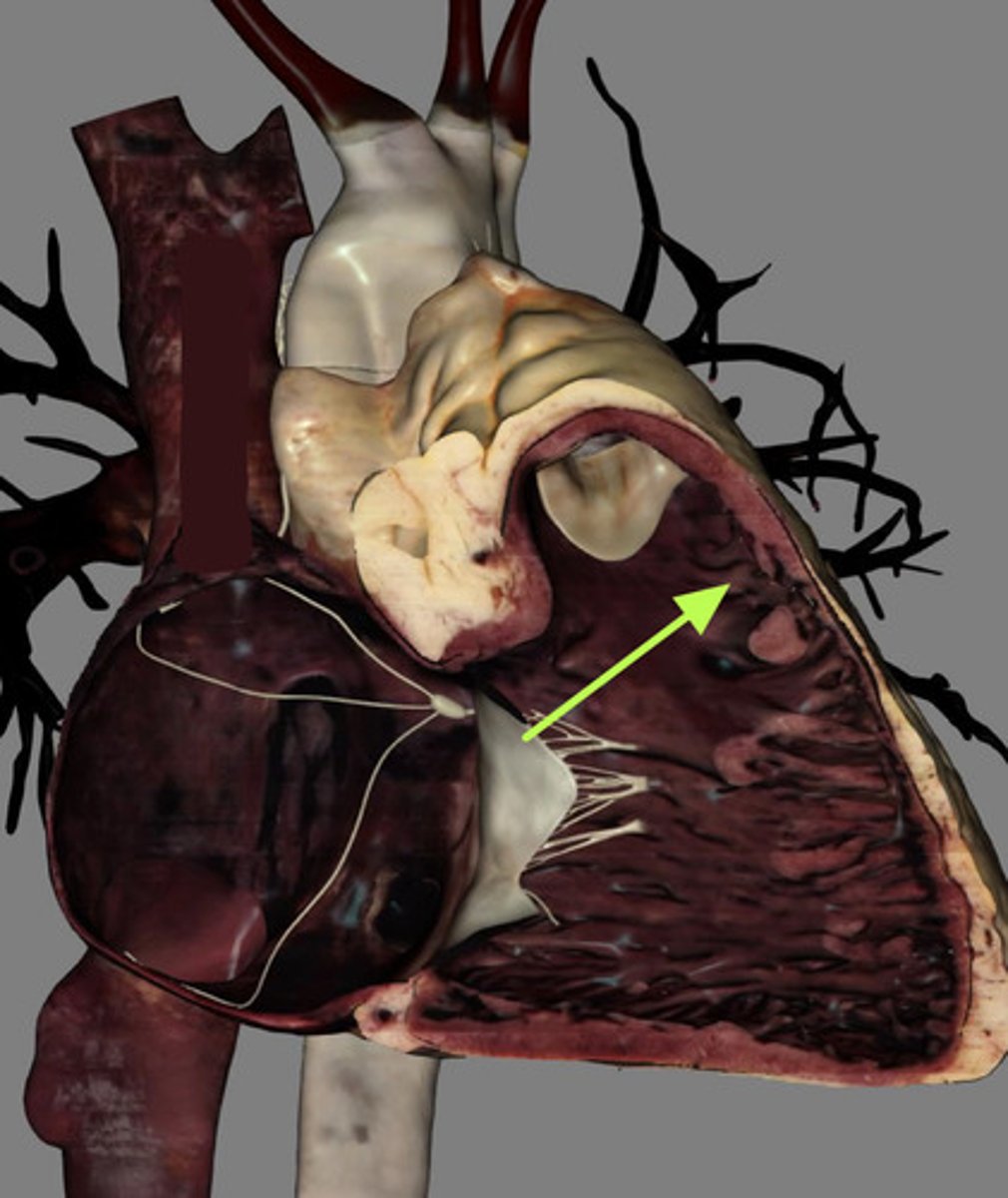 <p>muscular ridges on the internal surface of the ventricles</p>