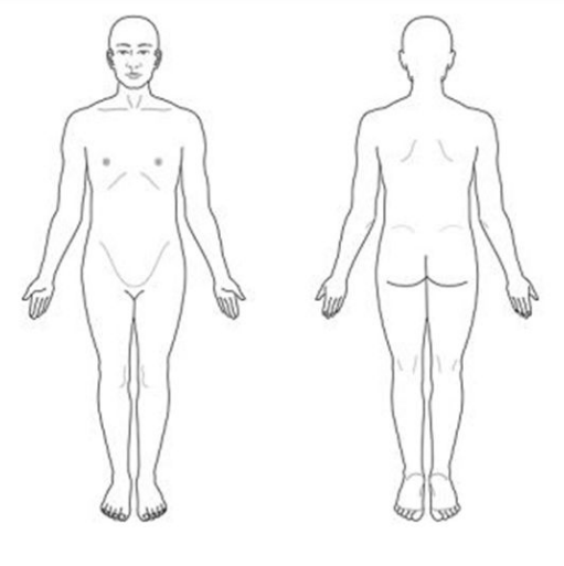 <p>It is the neutral anatomical position of the human body <br>• Standing upright <br>• Arms at the sides of torso <br>• Elbows extended <br>• Palms face forward <br>• Fingers extended <br>• Thumbs away from body <br>• Feet slightly parallel <br>• Toes oriented to the front</p>