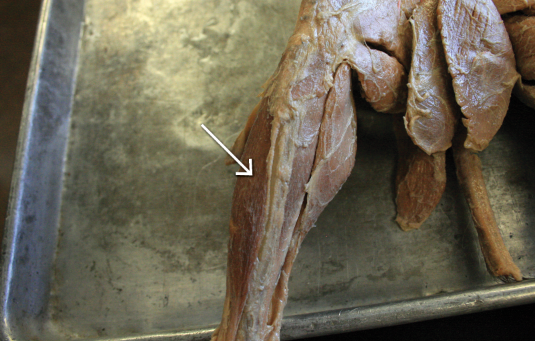 <p>anterior view </p>