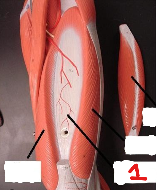 <p><span style="font-family: Arial, sans-serif">What is the origin and insertion of the muscle found at 1?</span></p>