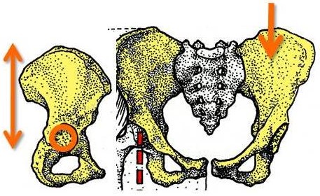 <p><span>bipedal human</span></p>