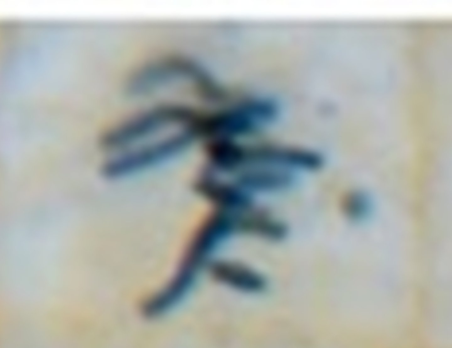 <p>Chromosomes at midline of cell (look like eyelashes)</p>