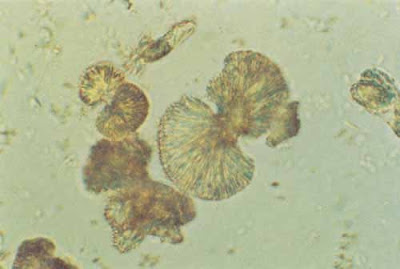 <p>Form in acidic pH </p>