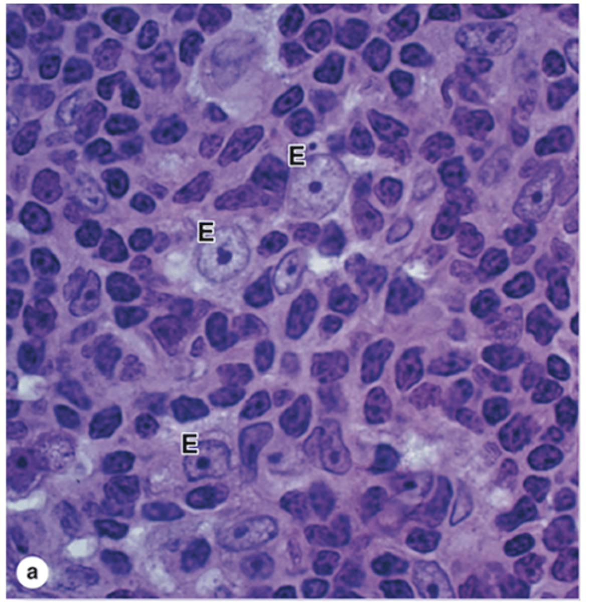 <p>Which type of cell is very abundant in the thymic cortex?</p>