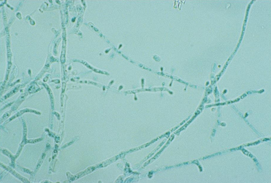 <p>colonies usually remain white on the surface but may be yellow to red. Most strains develop a red to deep burgundy wine colored pigment on the reverse that diffuses into the agar. Worldwide distribution.</p>