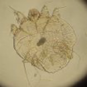 <p>what kind of mite</p>