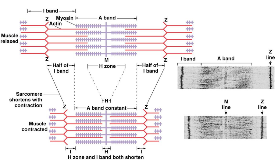 <p><strong>sarcomere</strong>: shrinks</p><p><strong>A band</strong>: stays constant</p><p><strong>I band</strong>: shrinks</p><p><strong>H zone</strong>: shrinks</p>