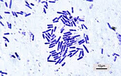 <ul><li><p>Large Gram +</p></li><li><p>Aerobic</p></li><li><p>Spore-forming</p></li><li><p>Chain bacilli</p></li></ul><p></p>