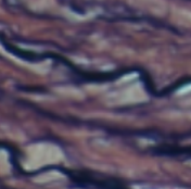 <p>Which type of tissue does this image depict?</p>