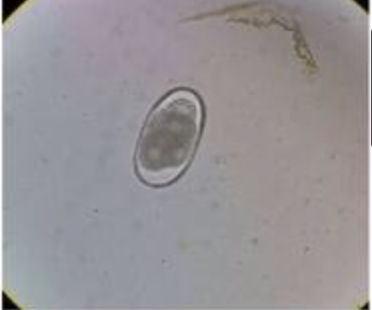 <p>ID the parasite egg</p>