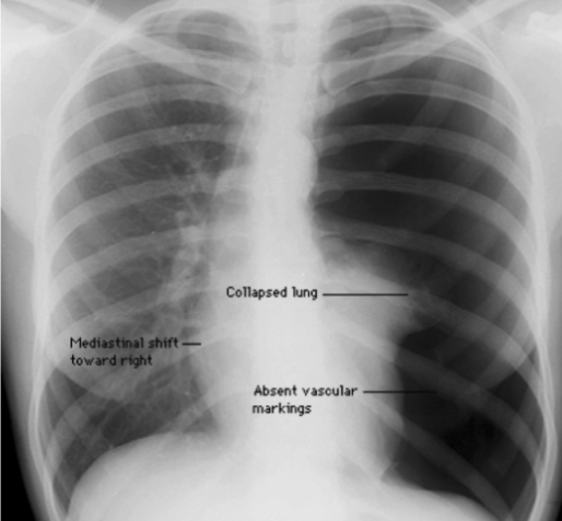 <p>diagnosis</p>