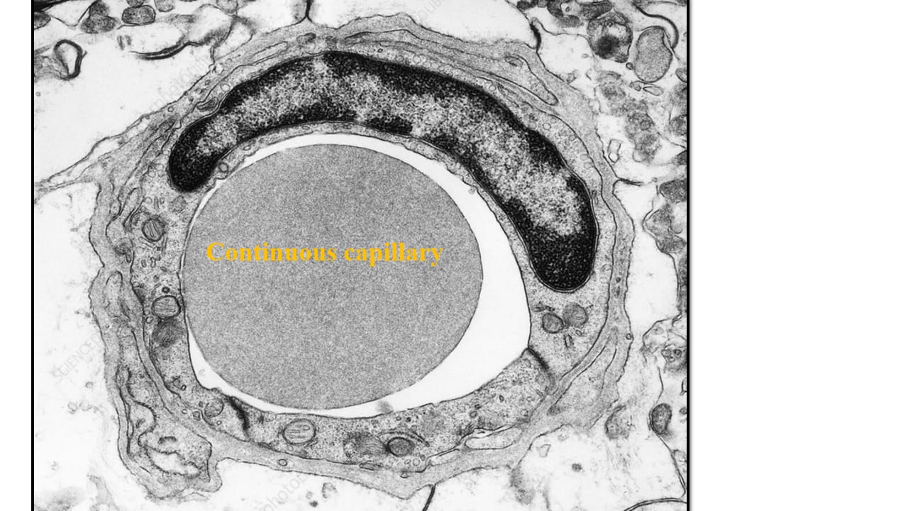 <p>Continuous capillary – EM</p>