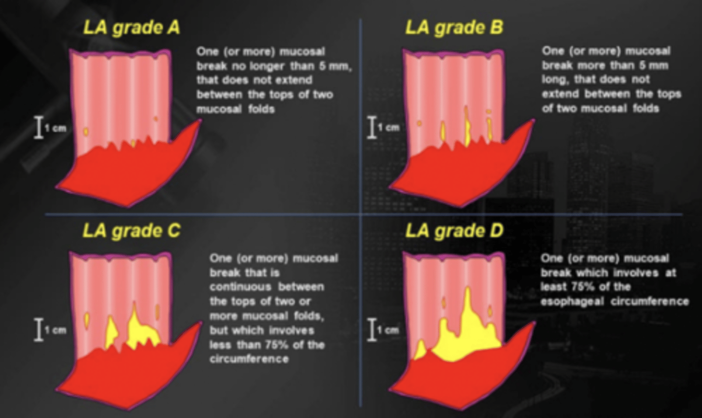 <p>LA grade A: best, mucosal break <5mm</p><p>LA grade D: worst, break >75%</p>