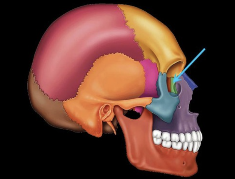 term image
